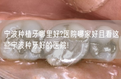 宁波种植牙哪里好?医院哪家好且看这些宁波种牙好的医院!
