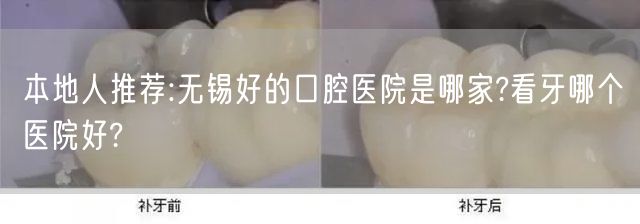本地人推荐:无锡好的口腔医院是哪家?看牙哪个医院好?
