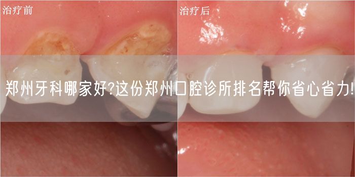 郑州牙科哪家好?这份郑州口腔诊所排名帮你省心省力!