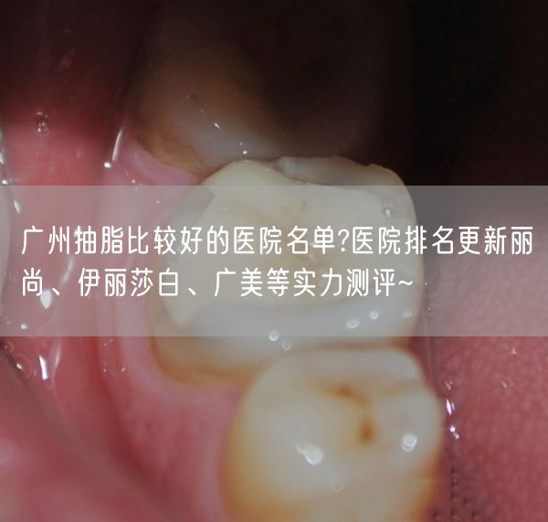 广州抽脂比较好的医院名单?医院排名更新丽尚、伊丽莎白、广美等实力测评~