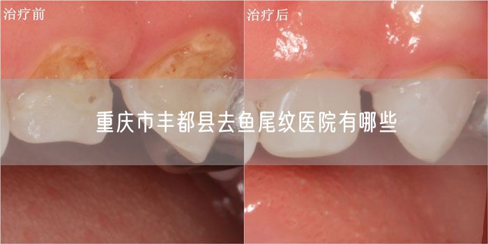 重庆市丰都县去鱼尾纹医院有哪些