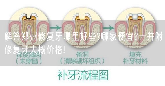 解答郑州修复牙哪里好些?哪家便宜?一并附修复牙大概价格!