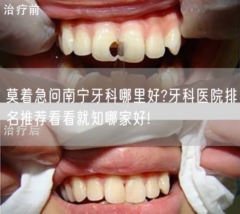 莫着急问南宁牙科哪里好?牙科医院排名推荐看看就知哪家好!