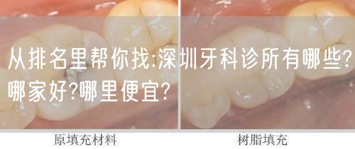 从排名里帮你找:深圳牙科诊所有哪些?哪家好?哪里便宜?