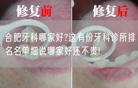 合肥牙科哪家好?这有份牙科诊所排名名单细说哪家好还不贵!