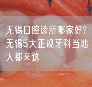 无锡口腔诊所哪家好?无锡5大正规牙科当地人都来这