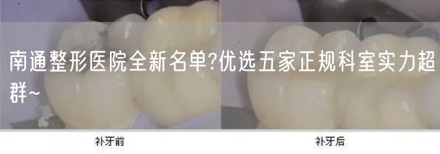 南通整形医院全新名单?优选五家正规科室实力超群~