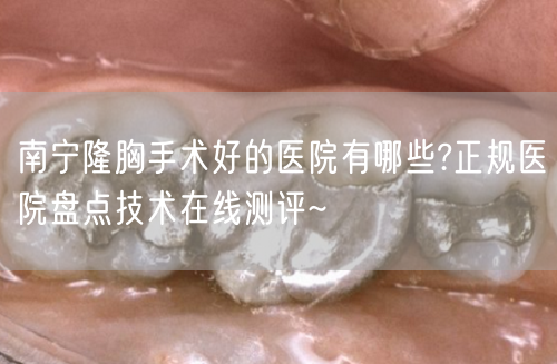 南宁隆胸手术好的医院有哪些?正规医院盘点技术在线测评~