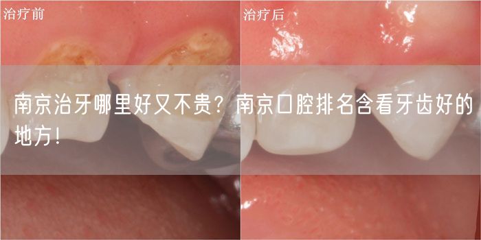 问重庆牙科诊所哪家好?牙科哪里便宜?看当地热门回答!