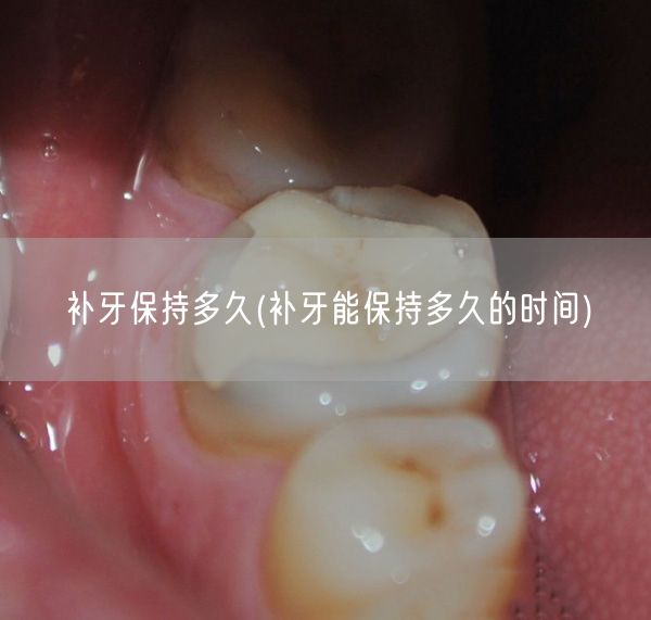 补牙保持多久(补牙能保持多久的时间)