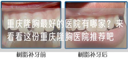 重庆隆胸最好的医院有哪家？来看看这份重庆隆胸医院推荐吧