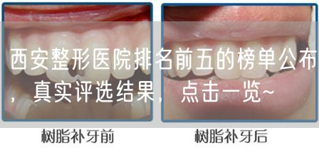 西安整形医院排名前五的榜单公布，真实评选结果，点击一览~