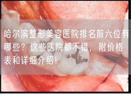 哈尔滨整形美容医院排名前六位有哪些？这些医院都不错，附价格表和详细介绍！