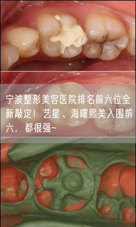 宁波整形美容医院排名前六位全新敲定！艺星、海曙熙美入围前六，都很强~
