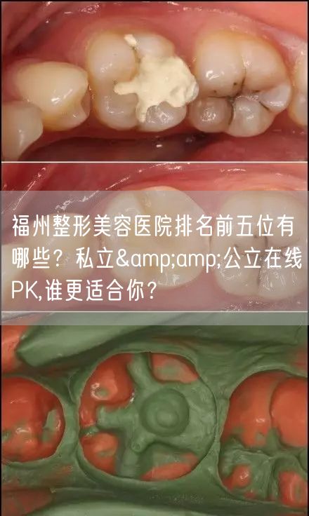 福州整形美容医院排名前五位有哪些？私立&amp;公立在线PK,谁更适合你？