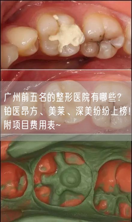 广州前五名的整形医院有哪些？铂医昂方、美莱、深美纷纷上榜！附项目费用表~