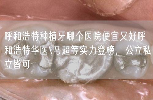 呼和浩特种植牙哪个医院便宜又好呼和浩特华医\马超等实力登榜，公立私立皆可