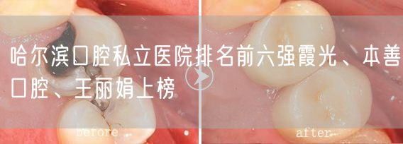 哈尔滨口腔私立医院排名前六强霞光、本善口腔、王丽娟上榜