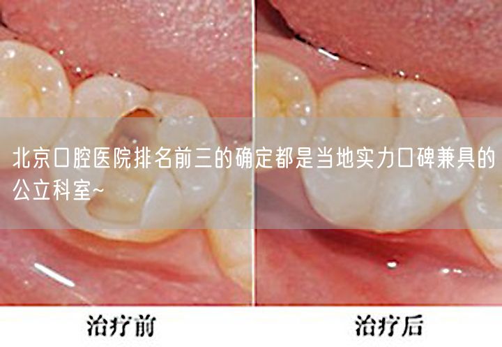北京口腔医院排名前三的确定都是当地实力口碑兼具的公立科室~