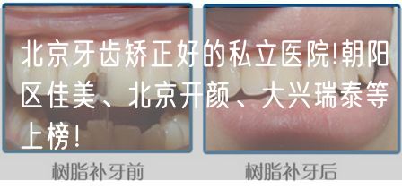 北京牙齿矫正好的私立医院!朝阳区佳美、北京开颜、大兴瑞泰等上榜！