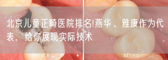北京儿童正畸医院排名!燕华、雅康作为代表，给你展现实际技术