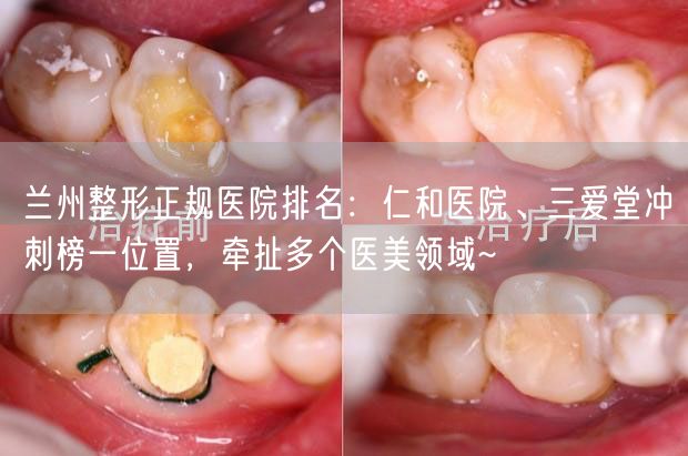 兰州整形正规医院排名：仁和医院、三爱堂冲刺榜一位置，牵扯多个医美领域~
