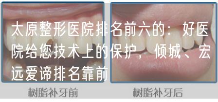 太原整形医院排名前六的：好医院给您技术上的保护，倾城、宏远爱谛排名靠前