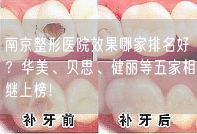 南京整形医院效果哪家排名好？华美、贝思、健丽等五家相继上榜！