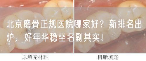 北京磨骨正规医院哪家好？新排名出炉，好年华稳坐名副其实！