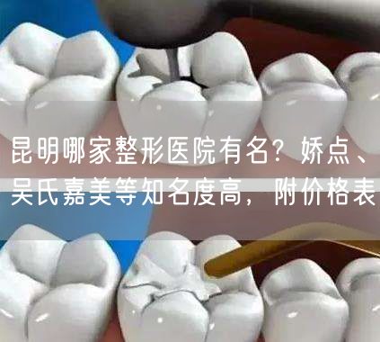 昆明哪家整形医院有名？娇点、吴氏嘉美等知名度高，附价格表