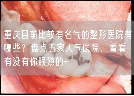 重庆目前比较有名气的整形医院有哪些？盘点五家人气医院，看看有没有你眼熟的~