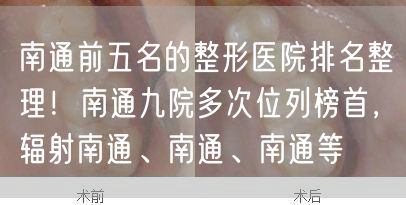 南通前五名的整形医院排名整理！南通九院多次位列榜首，辐射南通、南通、南通等