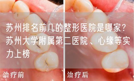 苏州排名前几的整形医院是哪家？苏州大学附属第二医院、心缘等实力上榜