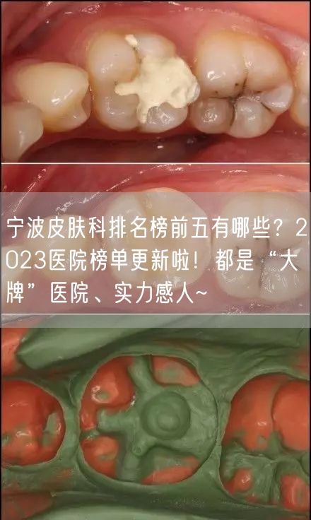 宁波皮肤科排名榜前五有哪些？2023医院榜单更新啦！都是“大牌”医院、实力感人~