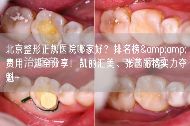 北京整形正规医院哪家好？排名榜&amp;费用，超全分享！凯丽汇美、张菡丽格实力夺魁~