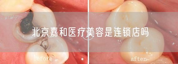 北京嘉和医疗美容是连锁店吗(图1)
