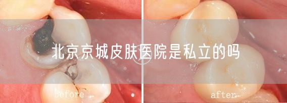 北京京城皮肤医院是私立的吗(图1)