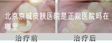 北京京城皮肤医院是正规医院吗在哪里
