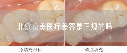 北京京美医疗美容是正规的吗