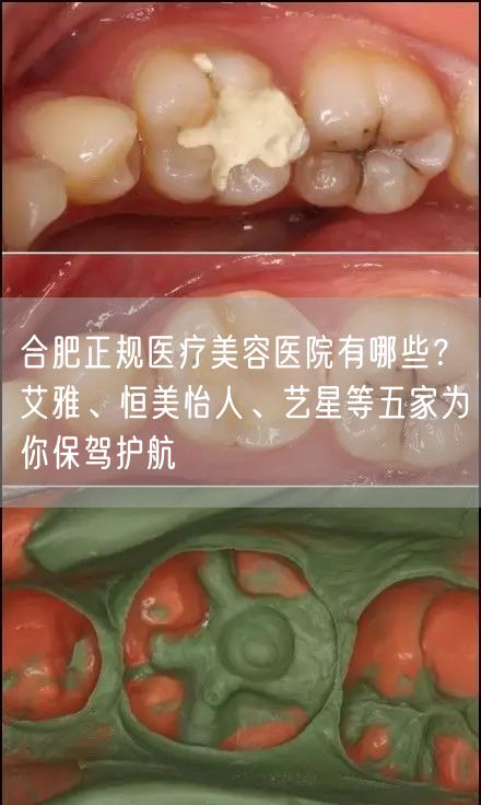 合肥正规医疗美容医院有哪些？艾雅、恒美怡人、艺星等五家为你保驾护航