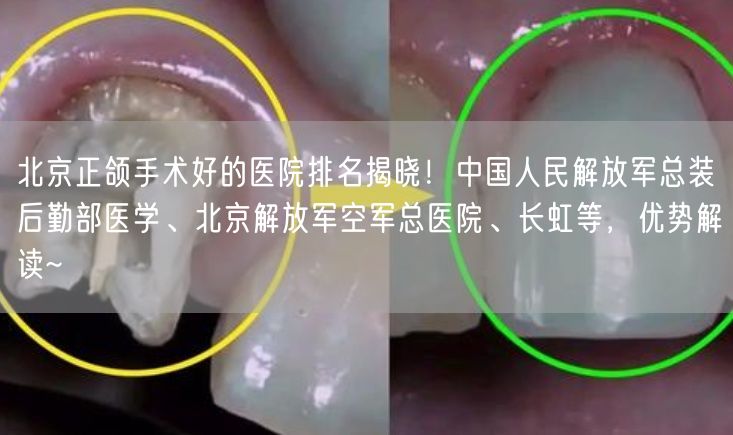 北京正颌手术好的医院排名揭晓！中国人民解放军总装后勤部医学、北京解放军空军总医院、长虹等，优势解读~