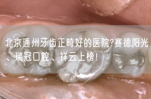 北京通州牙齿正畸好的医院?赛德阳光、瑞冠口腔、祥云上榜！