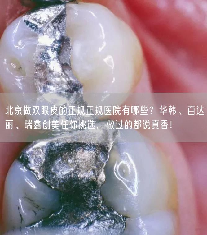 北京做双眼皮的正规正规医院有哪些？华韩、百达丽、瑞鑫创美任你挑选，做过的都说真香！