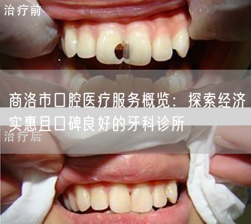 商洛市口腔医疗服务概览：探索经济实惠且口碑良好的牙科诊所