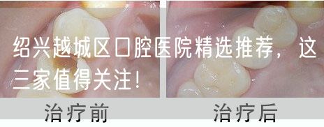 绍兴越城区口腔医院精选推荐，这三家值得关注！