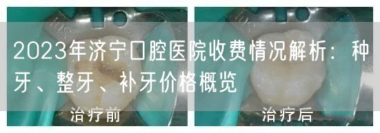 2023年济宁口腔医院收费情况解析：种牙、整牙、补牙价格概览