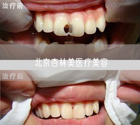 北京杏林美医疗美容(图1) 北京杏林美医疗美容(图1)