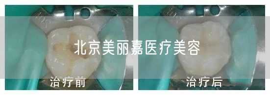 北京美丽嘉医疗美容(图1) 北京美丽嘉医疗美容(图1)