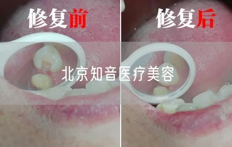 北京知音医疗美容(图1) 北京知音医疗美容(图1)