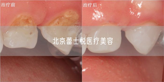 北京蕾士悦医疗美容(图1) 北京蕾士悦医疗美容(图1)